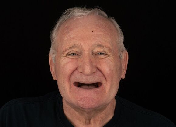 Before dental treatment