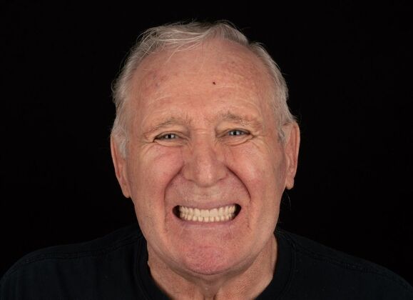 After dental treatment